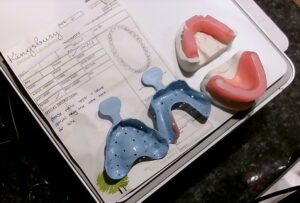 The HUE HD Pro USB camera makes dental record-keeping easy