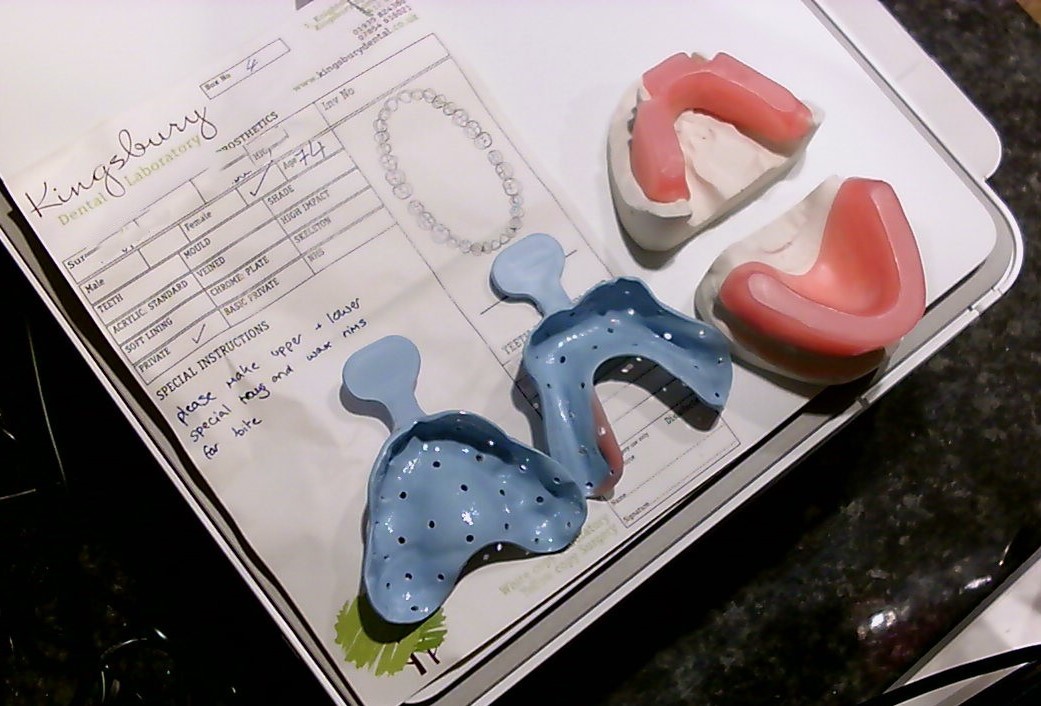 The HUE HD Pro USB camera makes dental record-keeping easy